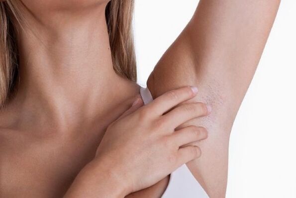 Papilloma under the armpits of a woman